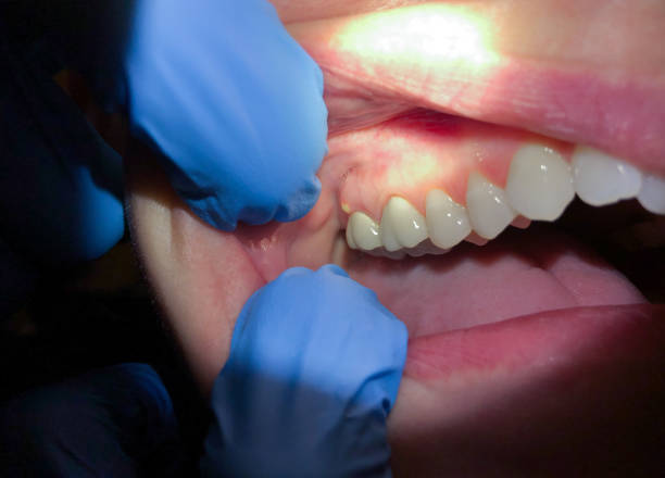 Best After-Hours Dental Trauma Care in Wormleysburg, PA